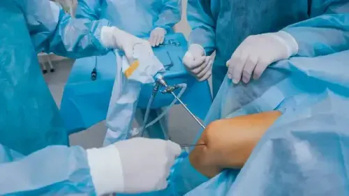 Arthroscopic Knee Surgery Cost in India